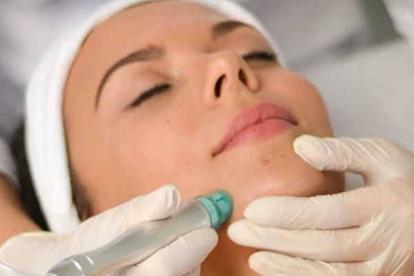 HydraLuxx-Hydrodermabrasion-Facial