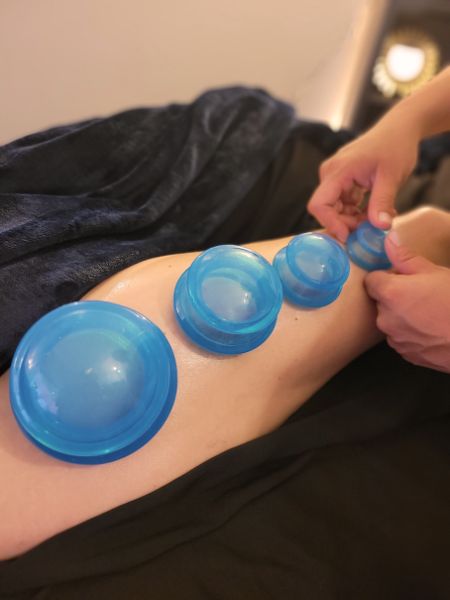 lake-powell-massage-cupping lake-powell-massage-cupping